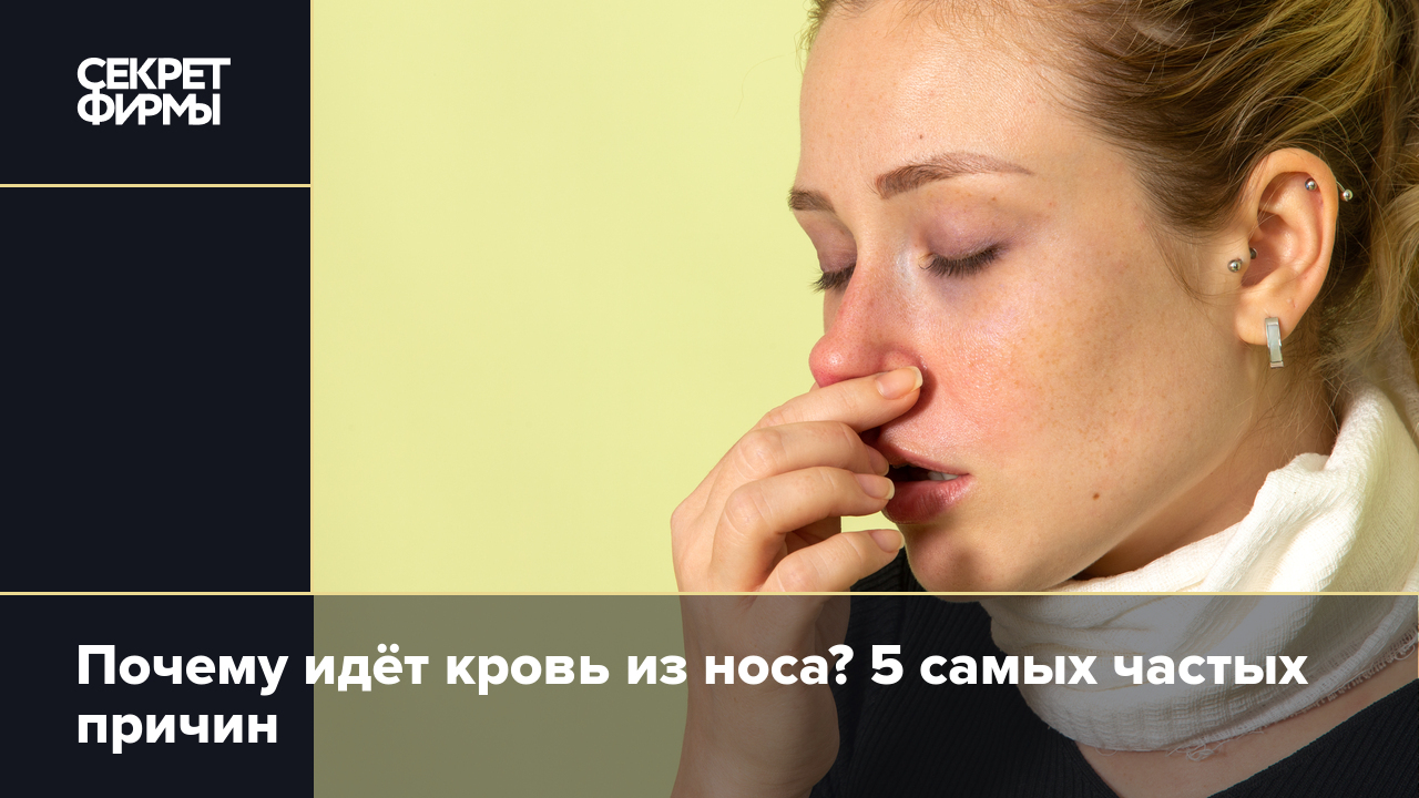 Почему идёт кровь из носа? 5 самых частых причин — Секрет фирмы