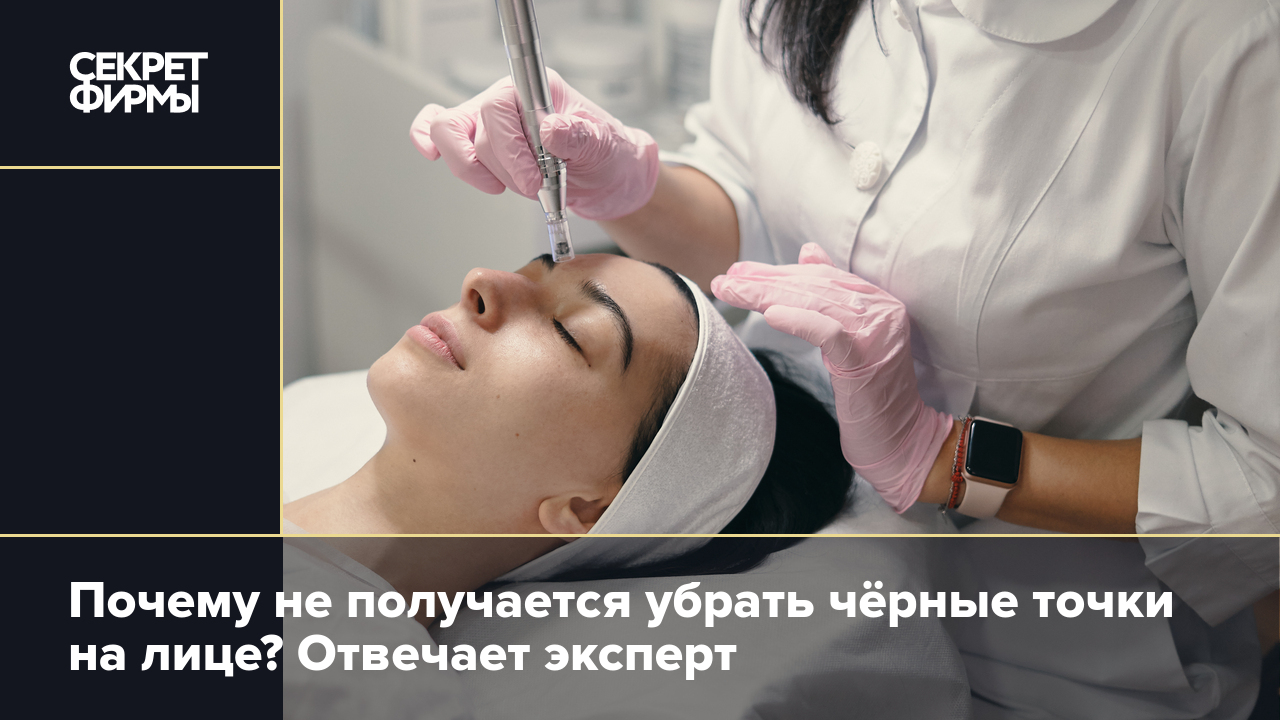 Почему не получается убрать чёрные точки на лице? Отвечает эксперт — Секрет  фирмы