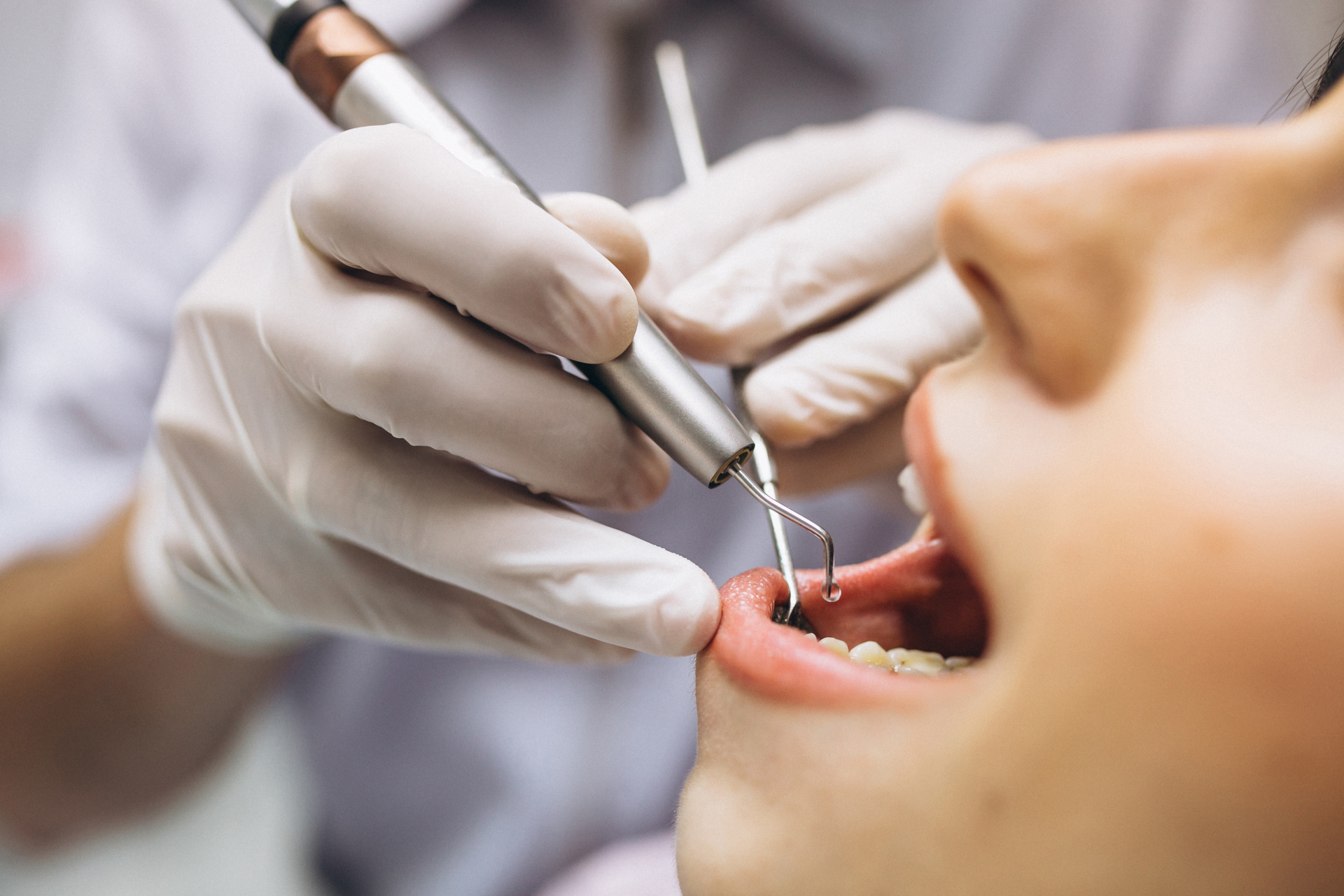 Эксперт Клоуда: стоматологические проблемы могут вызывать головную боль