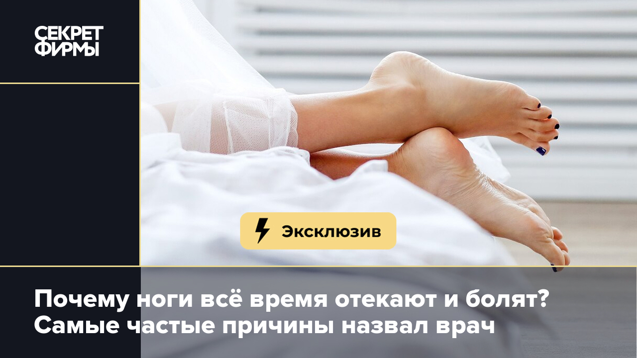 Почему ноги отекают и болят? Названы главные причины — Секрет фирмы