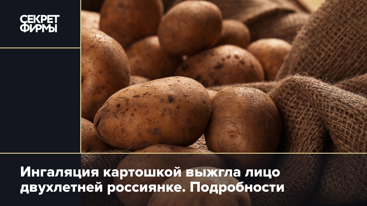 Девочка в Колпино получила ожоги на всё лицо, подышав над картошкой:  подробности — Секрет фирмы