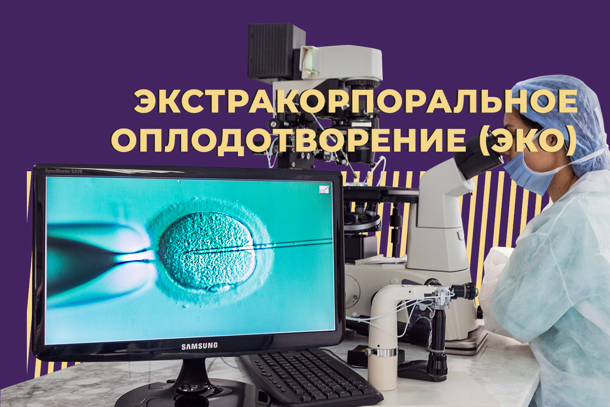 ЭКО: что это такое, из каких этапов состоит, как получить квоту и портит ли  ЭКО здоровье — Секрет фирмы