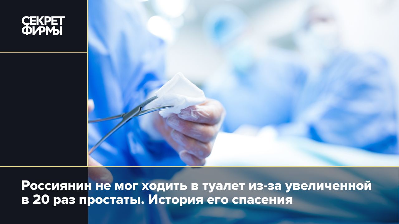 Врачи спасли россиянина с увеличенной в 20 раз простатой: подробности —  Секрет фирмы