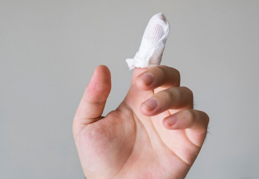 Обжёгся — пузырь в подарок. Почему появляются волдыри и что с ними делать