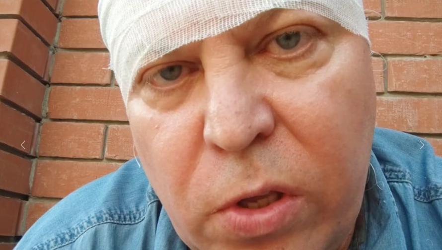 «Шли с палкой, избивали людей». Российский депутат попал в больницу после стычки с мигрантами