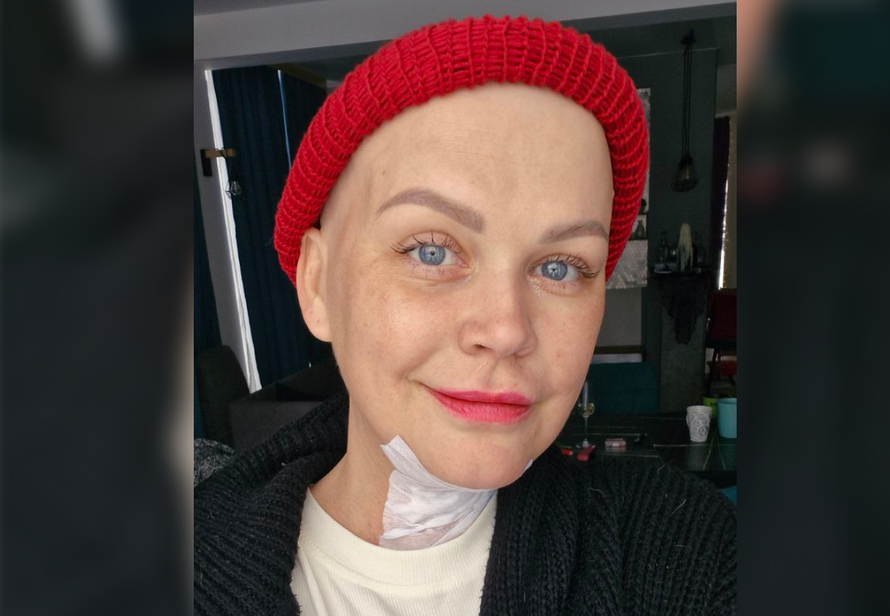 Звезда Первого канала полгода лечила рак таблетками от горла. К чему это привело