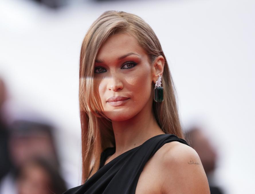 Из-за чего попала в больницу Белла Хадид? Это может быть не болезнь Лайма