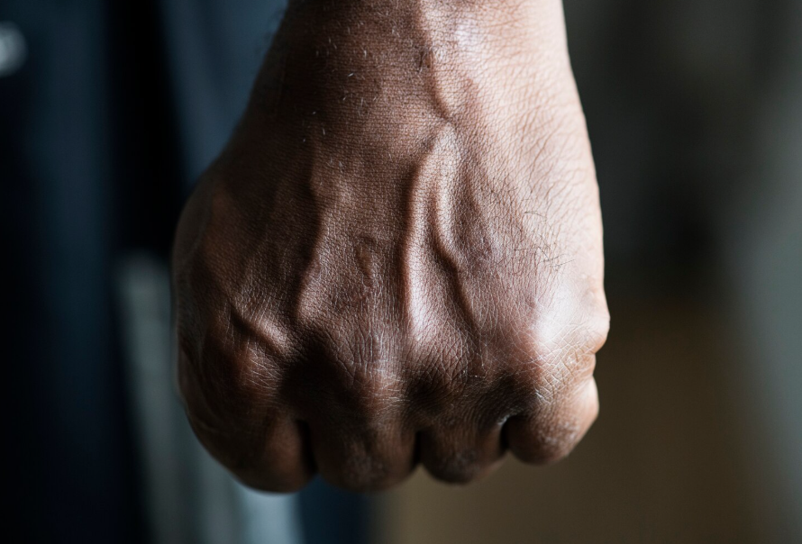 Россиянин разгромил машины во дворе и подрался с соседями. Одним из них оказался депутат гордумы